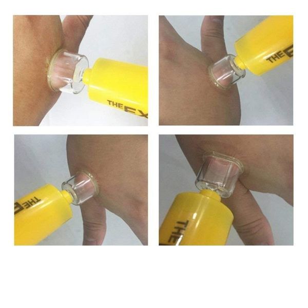 Екстрактор отрути - набір першої допомоги при укусах змій Sawyer extractor pump kit, зображення 5